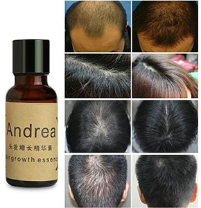 [2355] The Organic Hair Growth Essence 20ML As Seen On TV / THE ORIGINAL